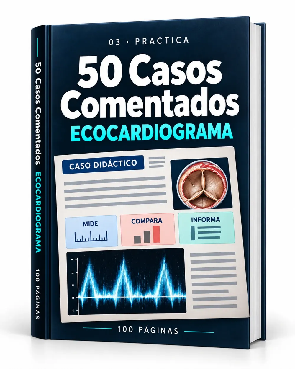 Mockup del PDF: 50 Casos Comentados de Ecocardiograma